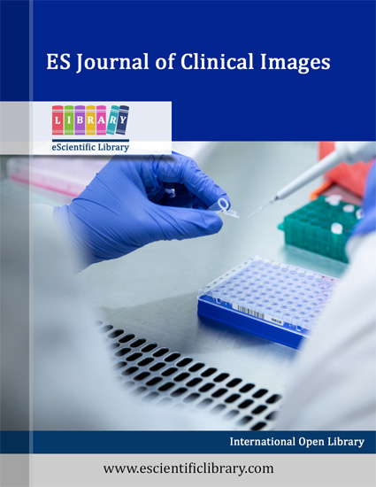 ES Journal of Clinical Images